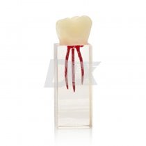 Ендоблок тренувальний (моляр, три канала) HST-N5/3