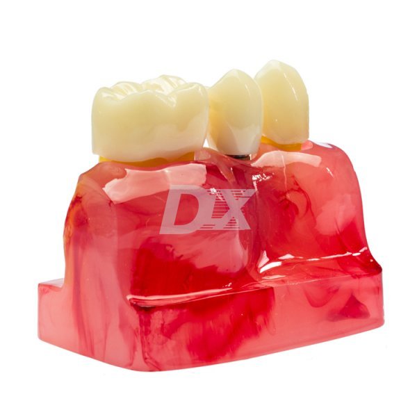 Модель демонстраційна часткова HST-М3-01 - фотография . Купить с доставкой в интернет магазине Dlx.ua.