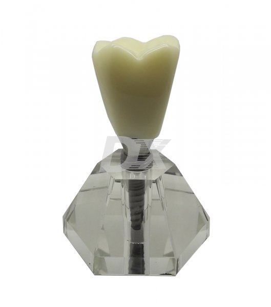 Модель демонстрационная имплант HST Е19-01 - фотография . Купить с доставкой в интернет магазине Dlx.ua.