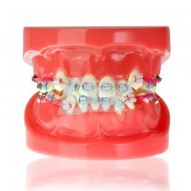 Модель демонстраційна ортодонтична з керамічними брекетами HTS-B1-03