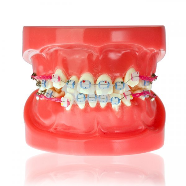 Модель демонстраційна ортодонтична з керамічними брекетами HTS-B1-03 - фото . Купити з доставкою в інтернет магазині Dlx.ua.