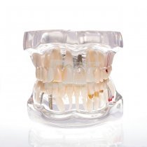 Модель демонстраційна зі знімними мостами HTS-C15