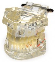 Модель навчальна хірургічна імплант 110-07