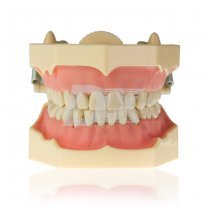 Модель тренувальна зі знімними зубами (нижня і верхня щелепи) HTS-A7-01