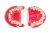 Модель демонстраційна ортодонтична з брекетами HTS-B4-02 - фотография 5. Купить с доставкой в интернет магазине Dlx.ua.