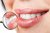 Скайс (страза) на зуби Swarovski - фото 2. Купити з доставкою в інтернет магазині Dlx.ua.