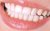 Скайс (страза) на зуби Swarovski - фотография 3. Купить с доставкой в интернет магазине Dlx.ua.