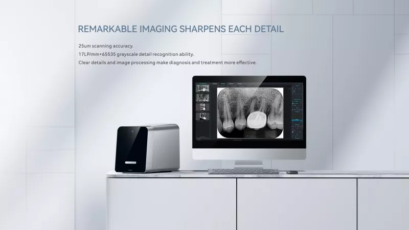 Сканер фосфорних пластин Woodpecker Free Scan — Рентген обладнання — photo 6